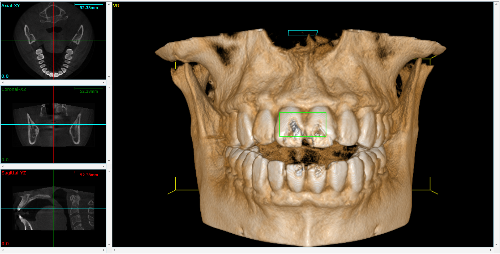 Cone Beam 3D Imaging  Duluth, MN